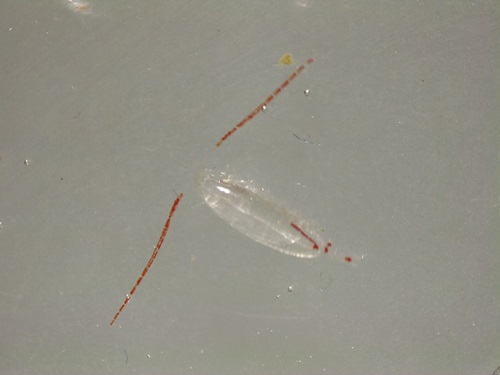 Isdronningen (mikroskopbillede)