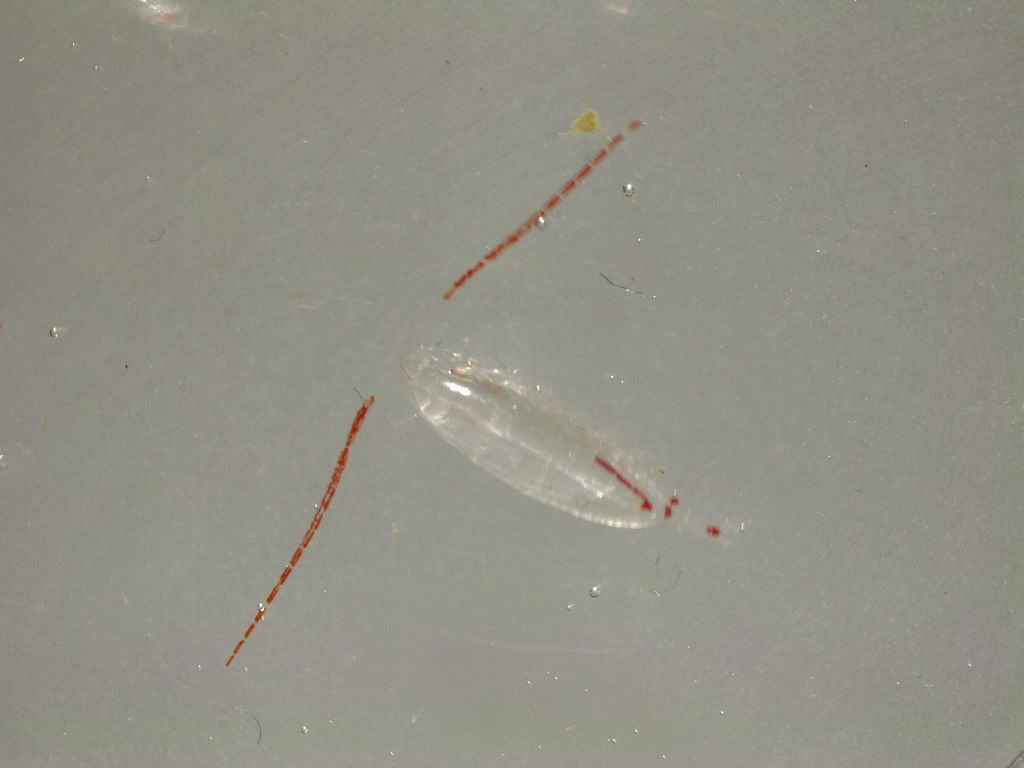Isdronningen (mikroskopbillede)