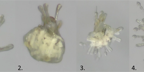 Metamorfoseprocessen: 1. Svømmende søpindsvinelarve, 2. Larve med ungdomsorganer under udvikling, 3. Aktiv metamorfose, 4. Ungt søpindsvin, der lever på havbunden (fotos: Sinja Rist).